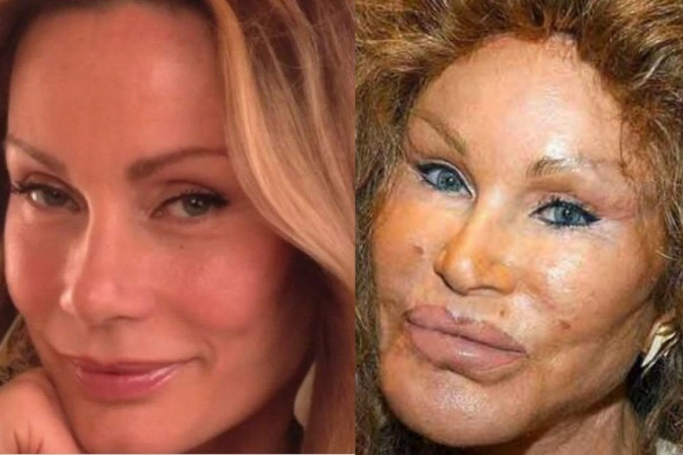 cat woman plastic surgery to look a like