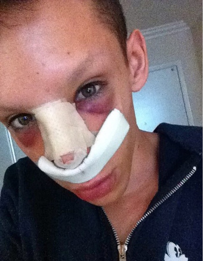 Man Spent $50,000 On Plastic Surgery To Transform Into A 'Genderless' Alien Man Spent $50,000 On Plastic Surgery To Transform Into A 'Genderless' Alien