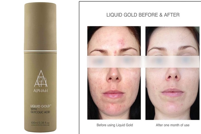 Alpha-H - Liquid Gold Alpha-H - Liquid Gold