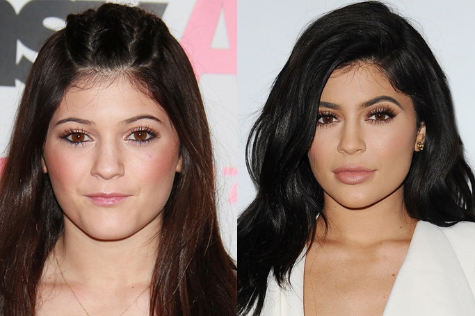 celebrity eyebrow before and after celebrity eyebrow before and after