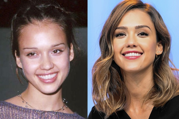 celebrity eyebrow before and after celebrity eyebrow before and after