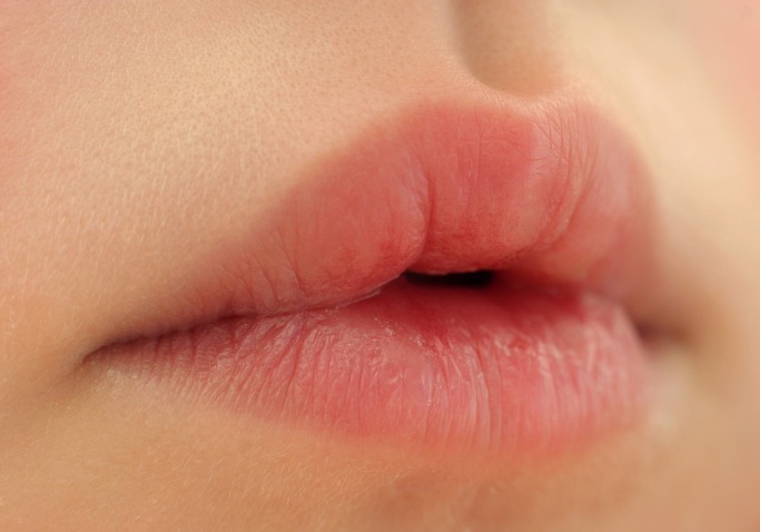 6 Signs You Are Not Drinking Enough Water 6 Signs You Are Not Drinking Enough Water