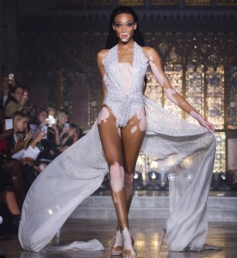 Winnie Harlow, VS model for 2018 Winnie Harlow, VS model for 2018