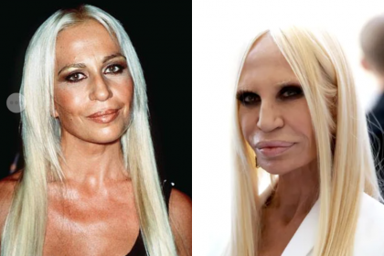 Donatella Versace  Celebrity plastic surgery, Beauty hacks, Plastic  surgery gone wrong